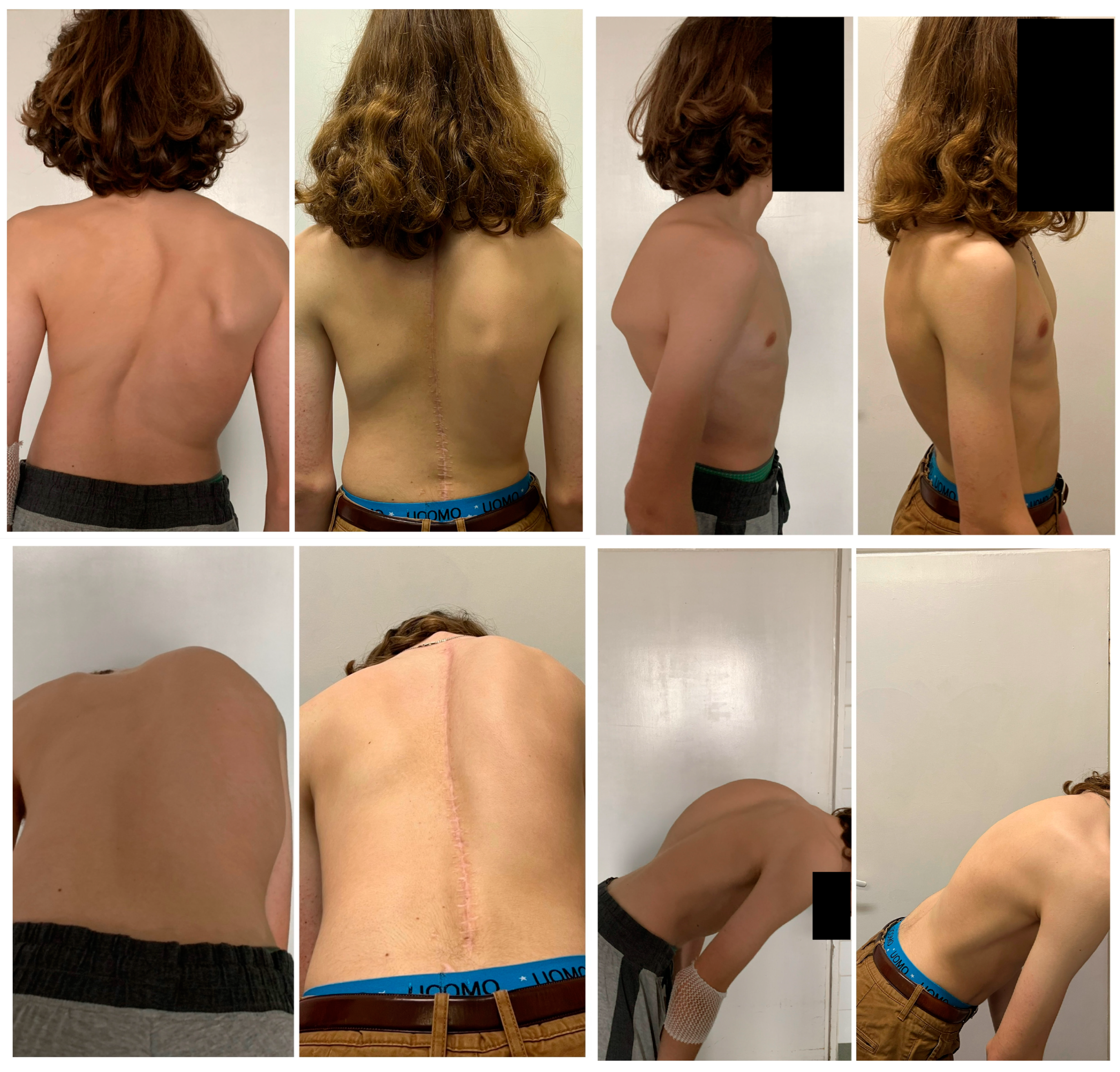 Children 1