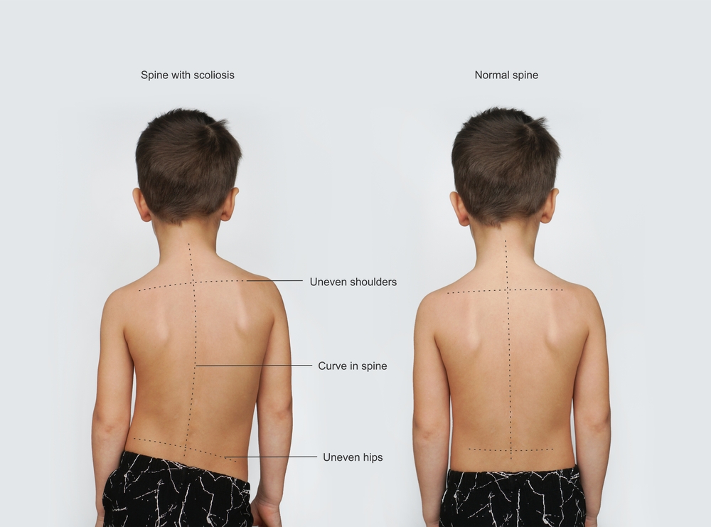 Children 6